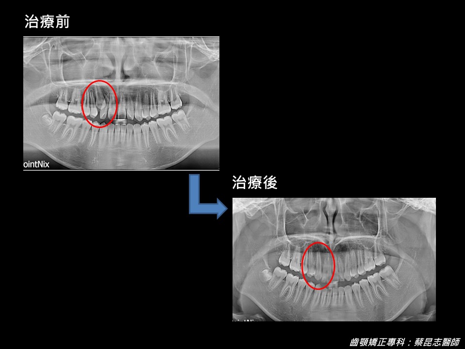 齒顎矯正 FT.蔡昆志醫師